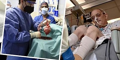Domuz kalbi nakledilen hastanın vücudu altı hafta sonra organı reddetti