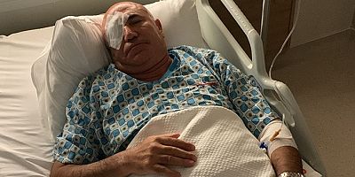 CHP Milletvekili Mahmut Tanal, polis müdahalesinde yaralandı