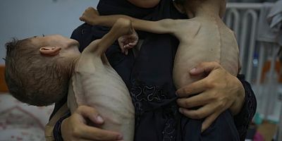 Gazze Sağlık Bakanlığı açıkladı: Açlık nedeniyle 11 kişi daha öldü