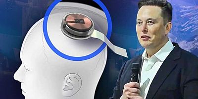 İnceleme kurulundan onay aldı! Elon Musk'ın beyin çipi şirketi klinik deneylere başlıyor 